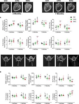 Hormonal and non-hormonal oral contraceptives given long-term to pubertal rats differently affect bone mass, quality and metabolism